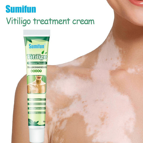 Sumifun Vitiligo Treatment Ointment Sweat Sport Remove