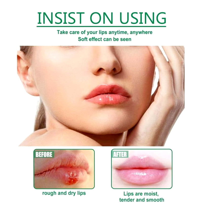 ঠোঁটের কালচে দাগ দূরীভূত লিপ জেল Herbal Medicated Lip Balm